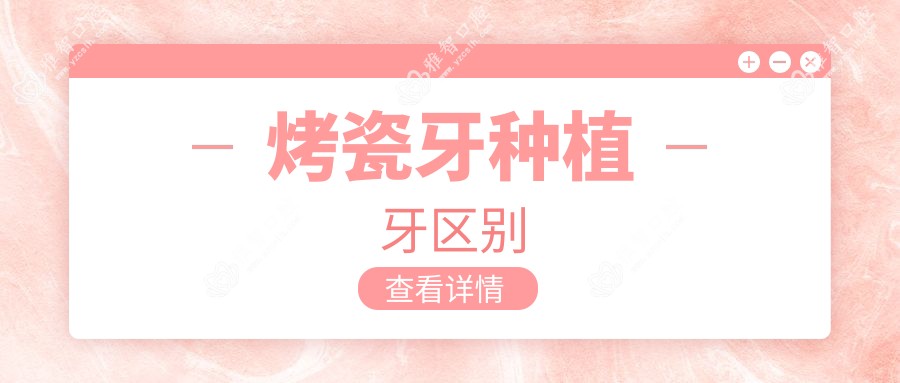 烤瓷牙种植牙区别