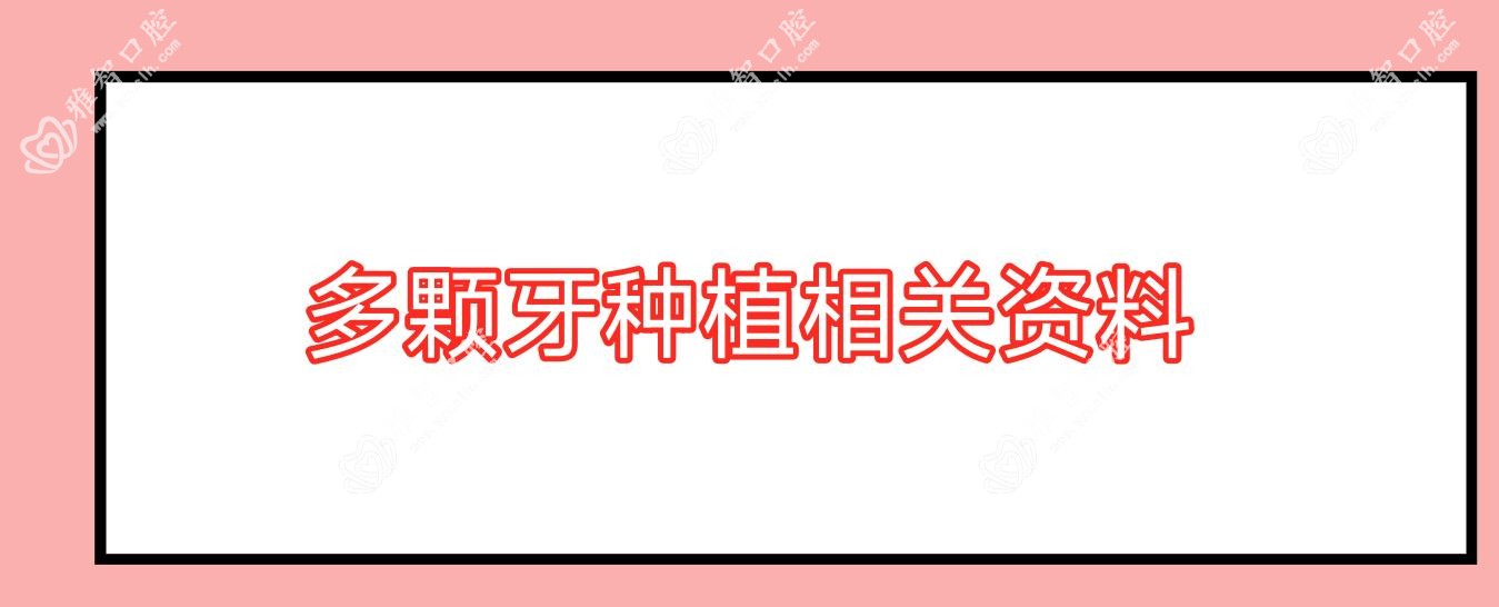 多颗牙种植相关资料