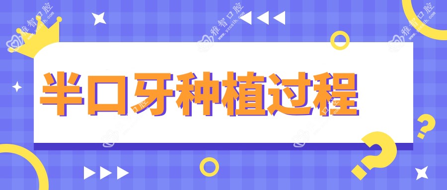 半口牙种植过程