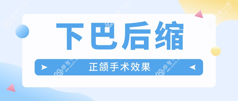 下巴后缩正颌手术疗效