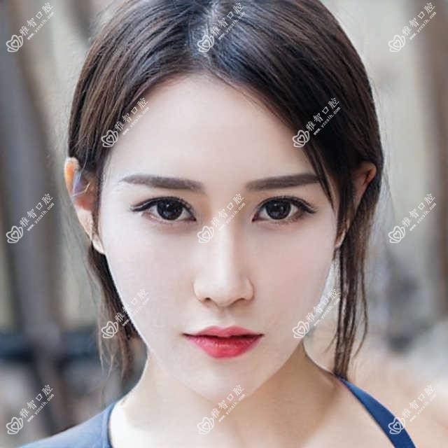 牙龈萎缩的详细资料?牙龈萎缩手术注意事项?
