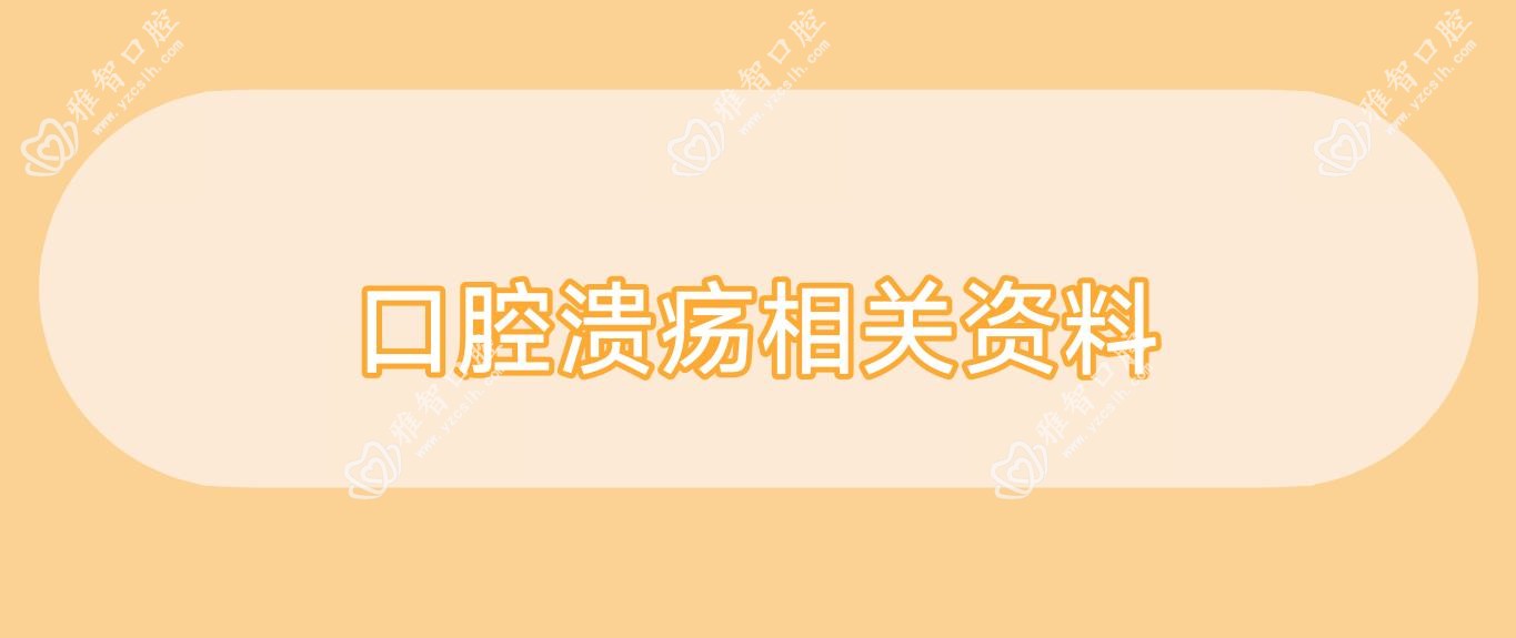 口腔溃疡相关资料