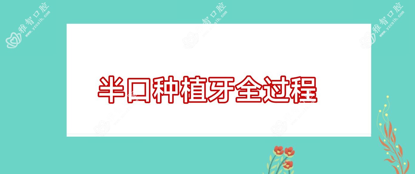 半口种植牙全过程