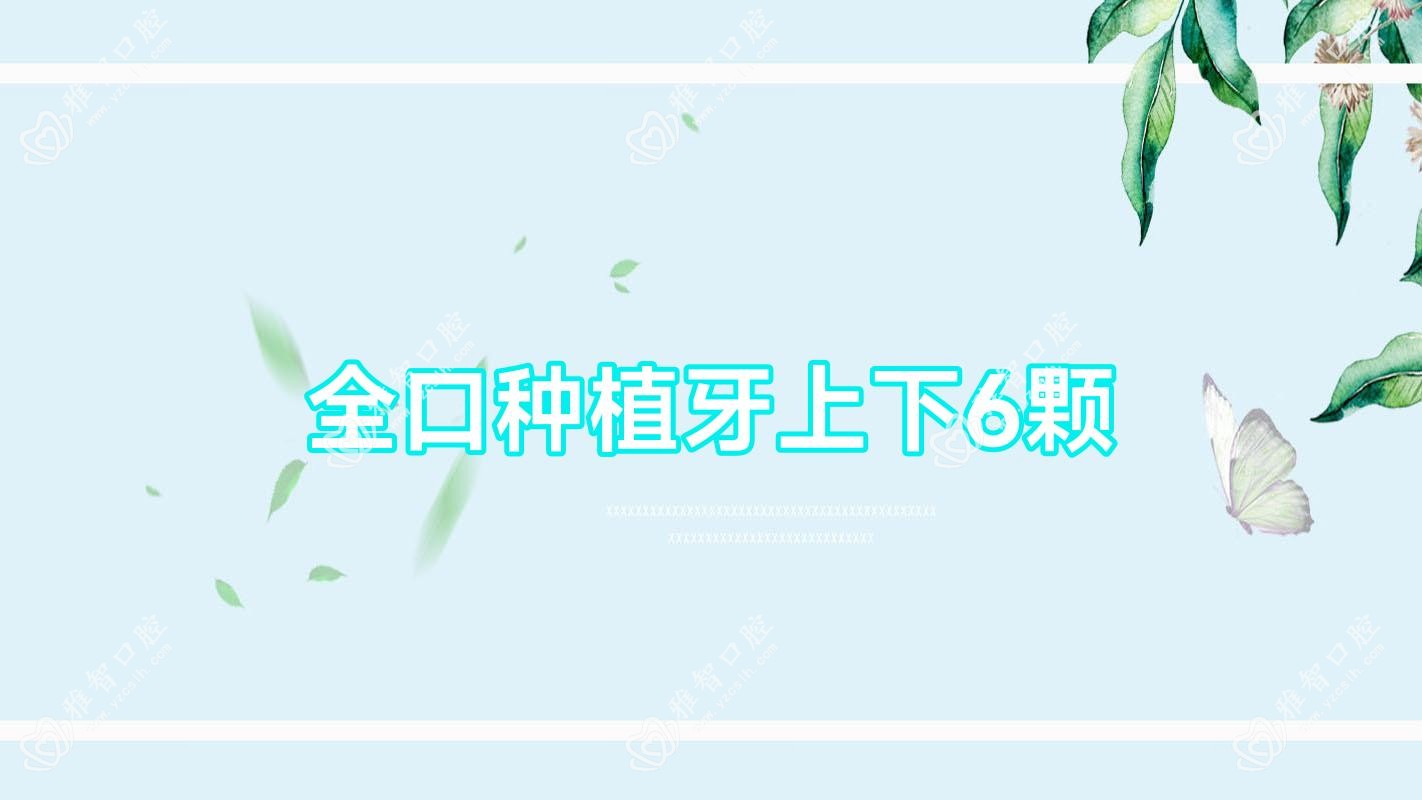 全口种植牙上下6颗