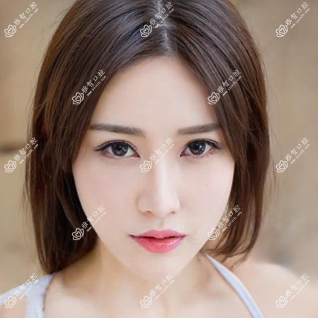贵阳2025深覆合正颌手术收费价目单:凸嘴正颌手术/龅牙正颌手术/深覆合正颌手术价格表明细展示!