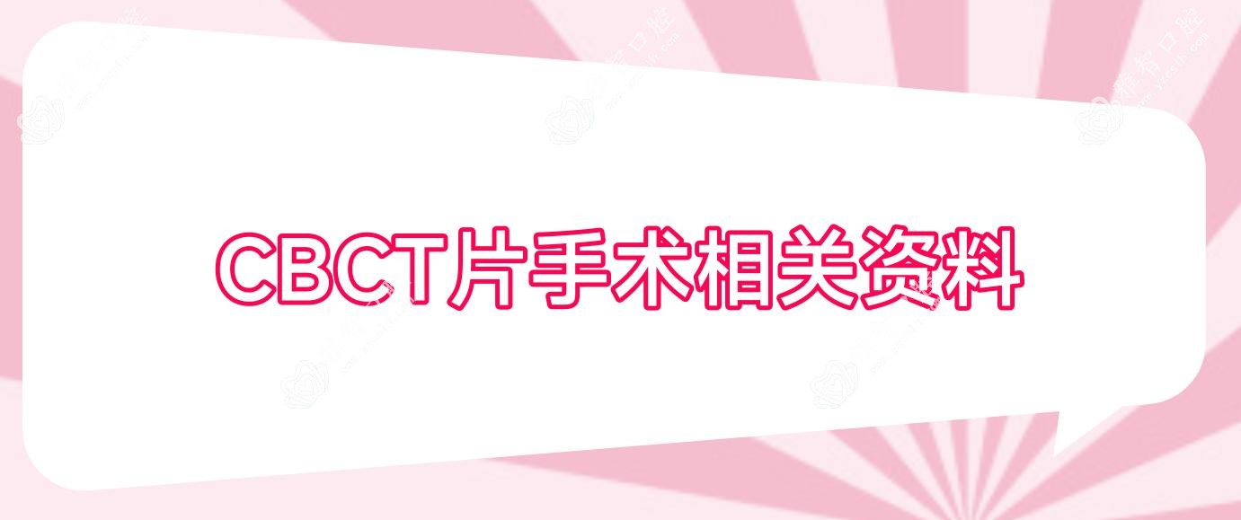 CBCT片手术相关资料