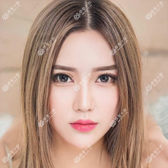 杭州黑牙美白价格多少钱?2025价目表:色素牙美白0.4k元起、黑牙美白0.4k元起