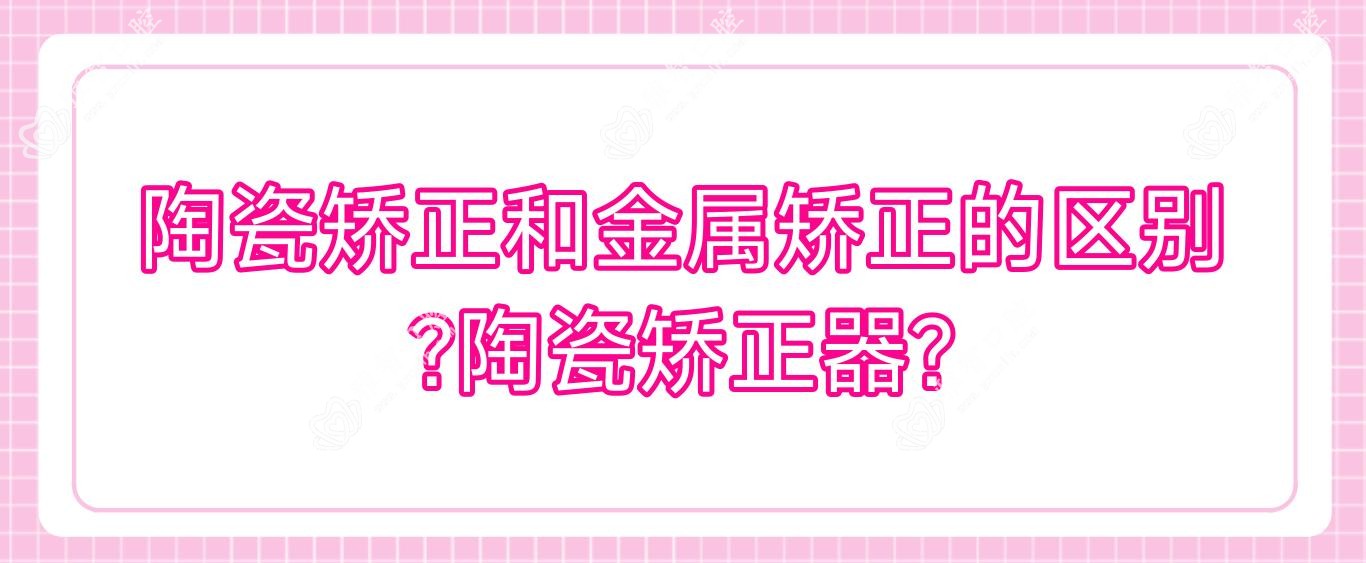 陶瓷矫正和金属矫正的区别?陶瓷矫正器?
