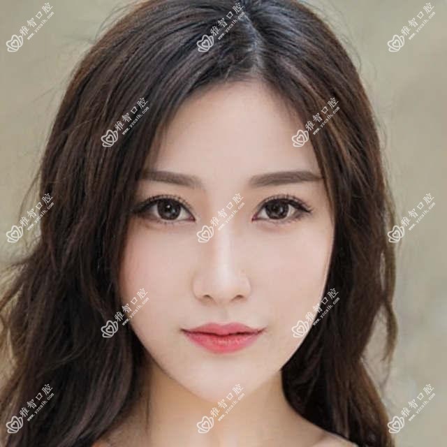 临沂美国3I种植牙价目单总览,想变好看的朋友可以参考