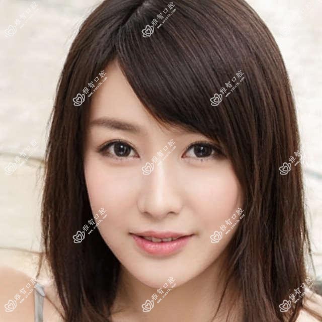 金属托槽矫正考虑因素有哪些?金属托槽矫正手术疼吗？以及恢复时间介绍?