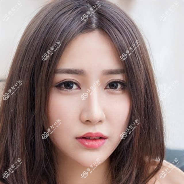 嘉兴时代天使隐形矫正器多少钱?2025年详细时代天使隐形矫正器价格表