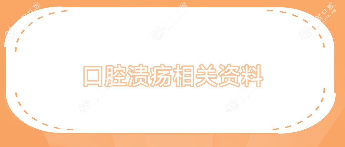 口腔溃疡相关资料