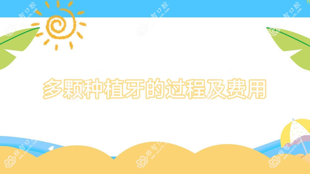 多颗种植牙的过程及费用