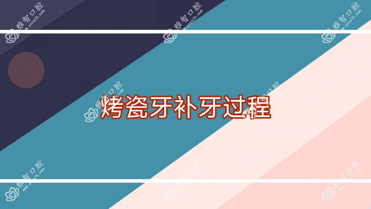 烤瓷牙补牙过程