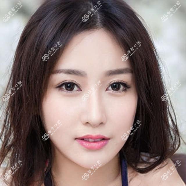 潍坊半口种植牙收费价格表2025(潍坊半口种植牙价格预览表)