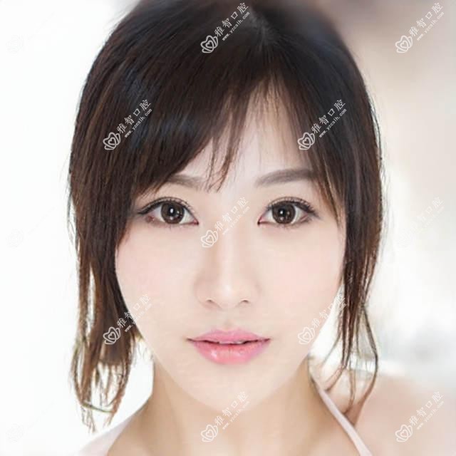 佛山全口种植牙价格明细2025新版,佛山全口种植牙/全口种植牙多少钱
