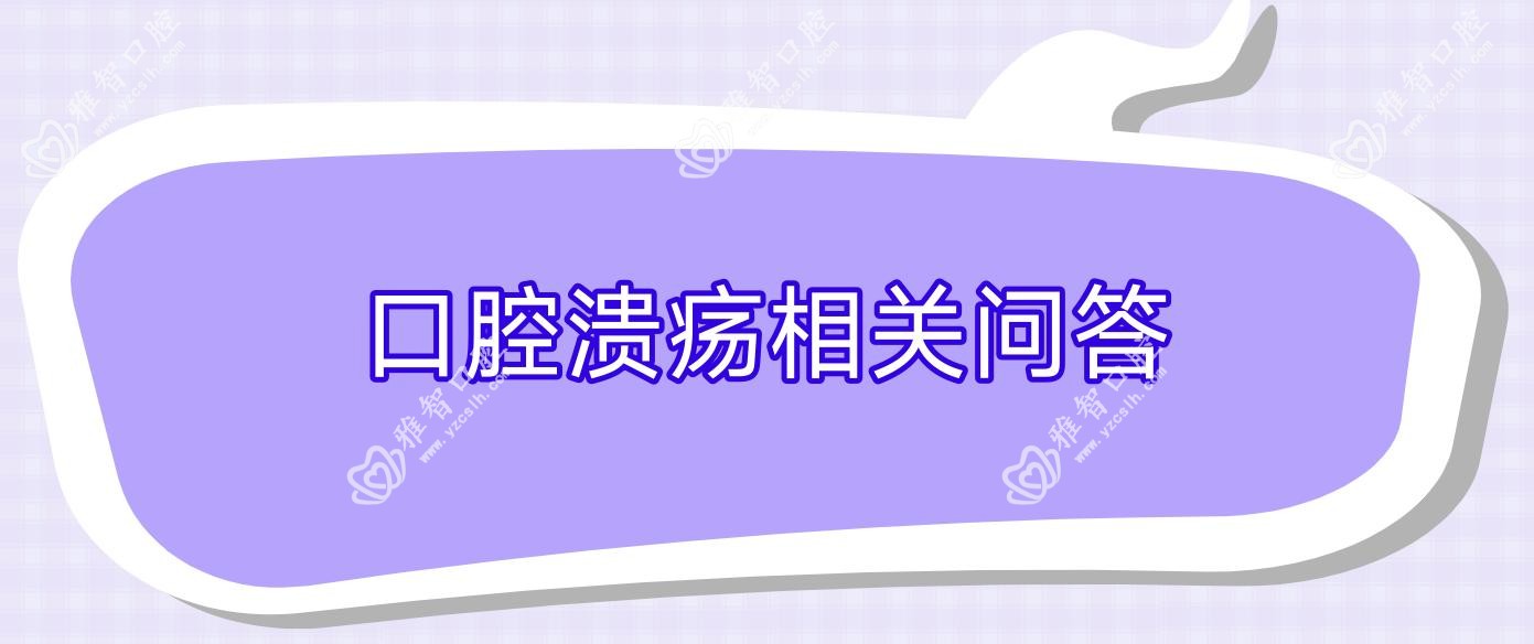 口腔溃疡相关问答