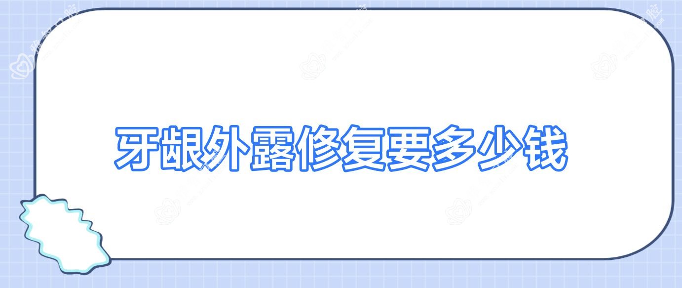 牙龈外露修复要多少钱