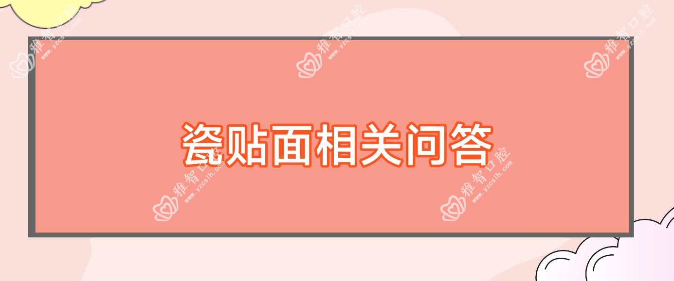 瓷贴面相关问答