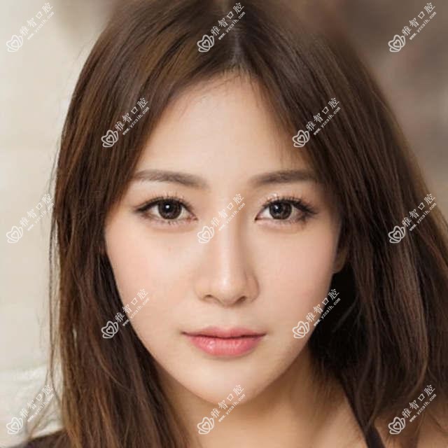 南京雨花台区医院脸型不对称正颌手术多少钱?脸型不对称正颌手术151090元