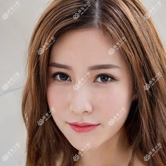 嵌体修复怎么治疗(嵌体修复相关操作详细介绍)