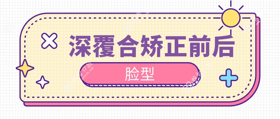 深覆合矫正前后脸型