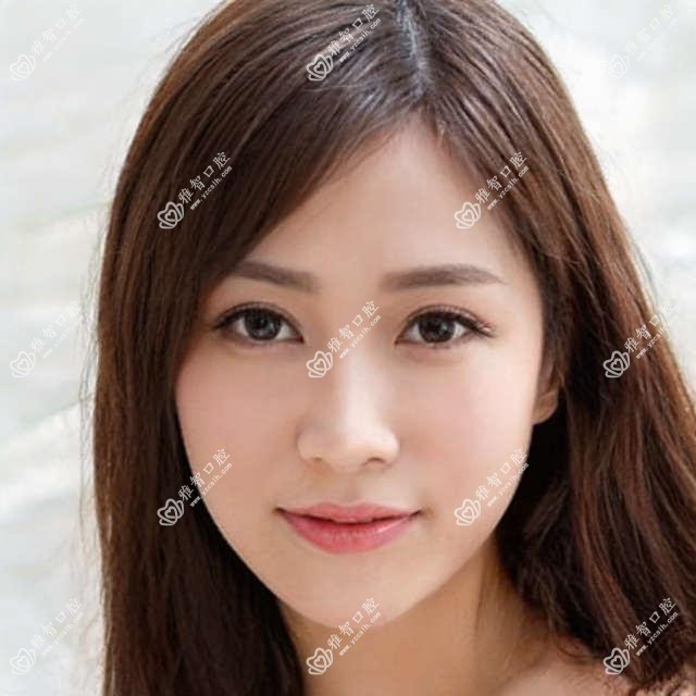 2025年长春金泰克种植牙价格表:金泰克种植牙3760+威高WeGo种植体3.8千+拜阿蒙种植牙4千+康德泰种植牙4千+