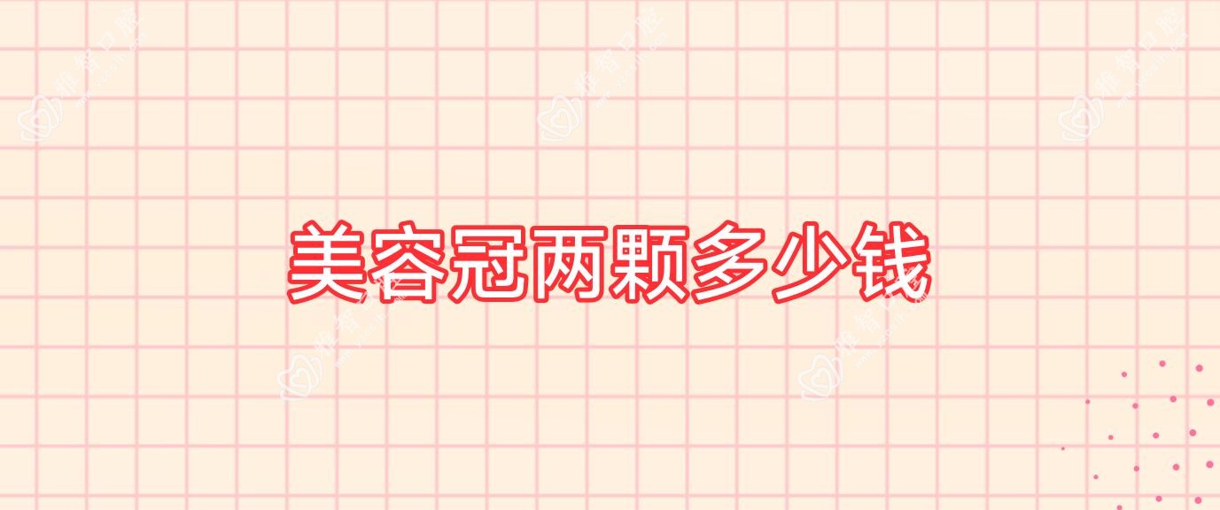 美容冠两颗多少钱