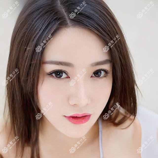 沈阳全口种植牙收费:起价3790元起,在线预约医生