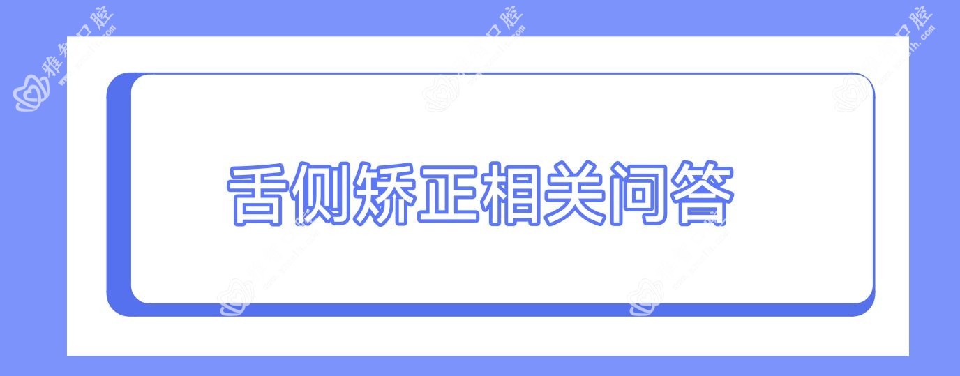 舌侧矫正相关问答