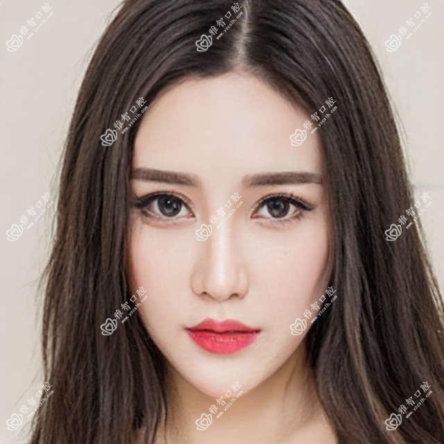 正雅需要注意什么?正雅手术注意事项?