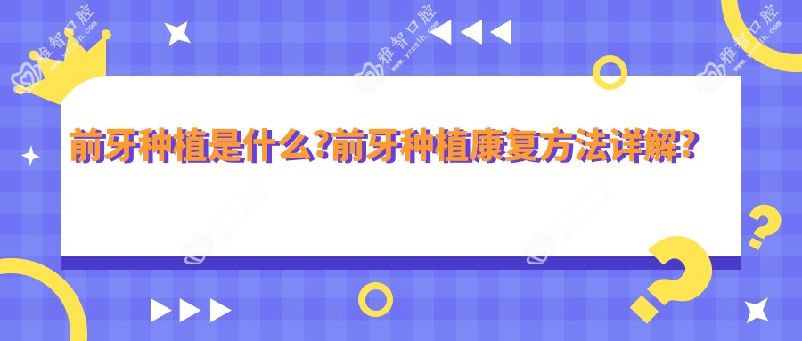 前牙种植是什么?前牙种植好转方法详解?