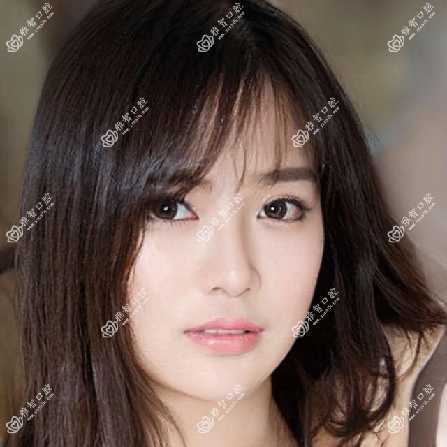 杭州浅龋收费明细2025新版,杭州浅龋/牙痛多少钱