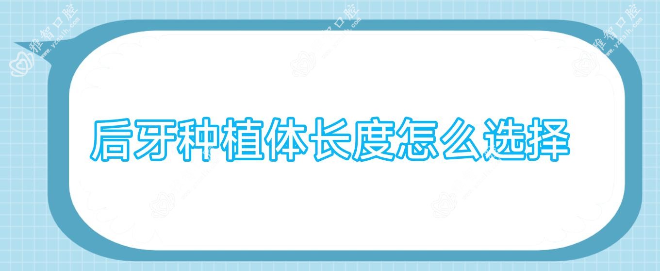 后牙种植体长度怎么选择