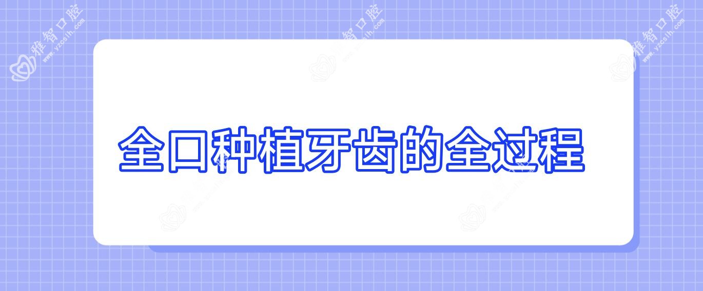 全口种植牙齿的全过程