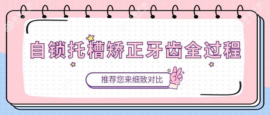自锁托槽矫正牙齿全过程