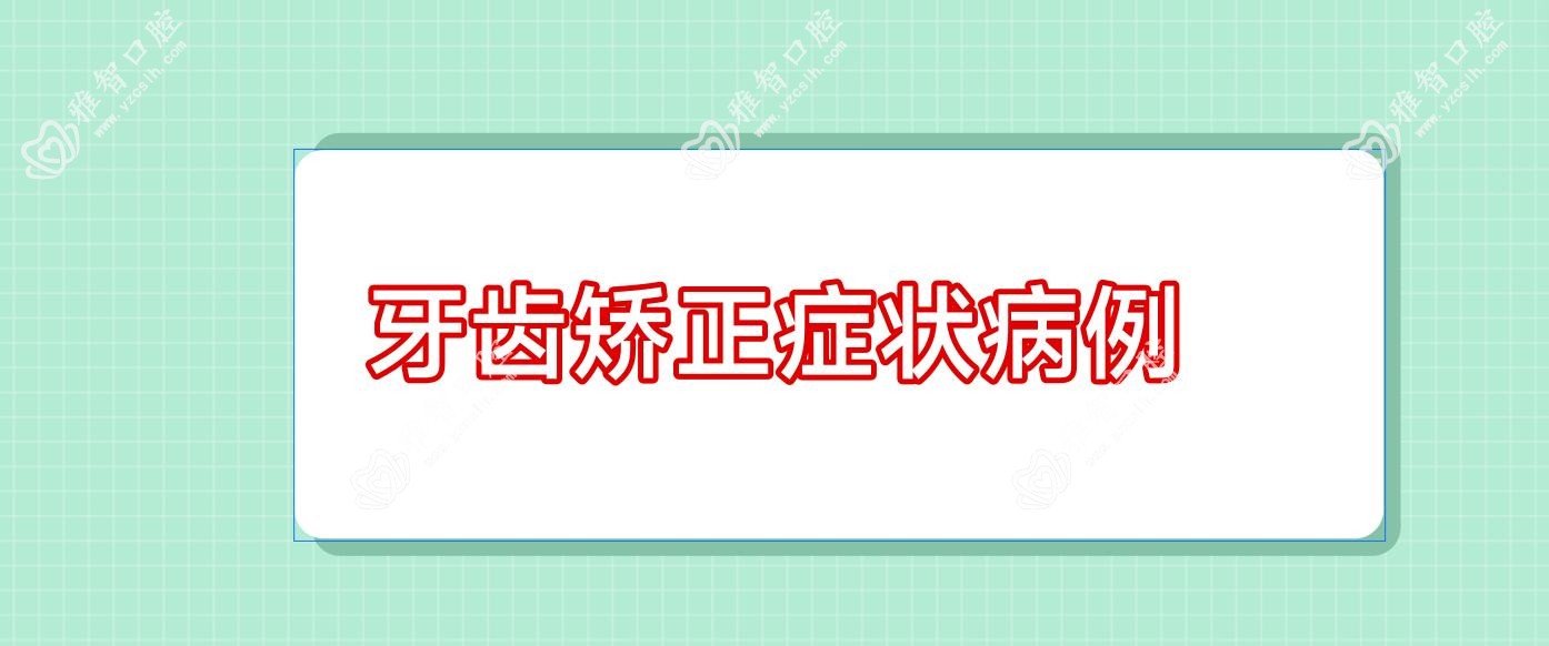 牙齿矫正症状病例