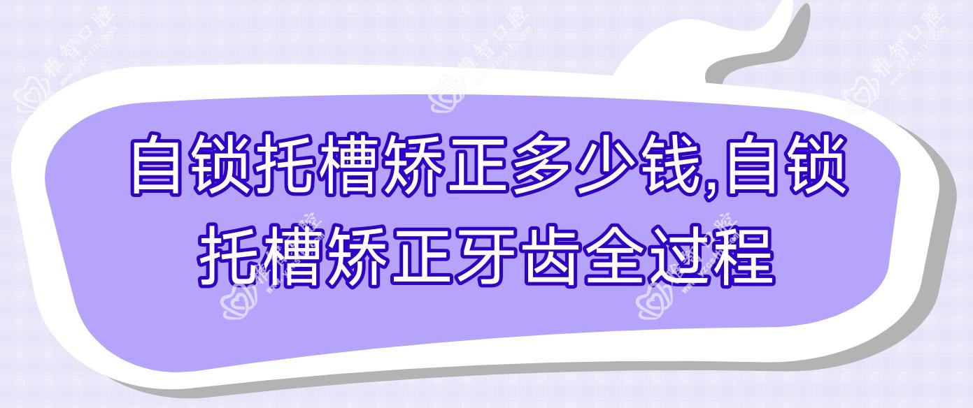 自锁托槽矫正多少钱,自锁托槽矫正牙齿全过程