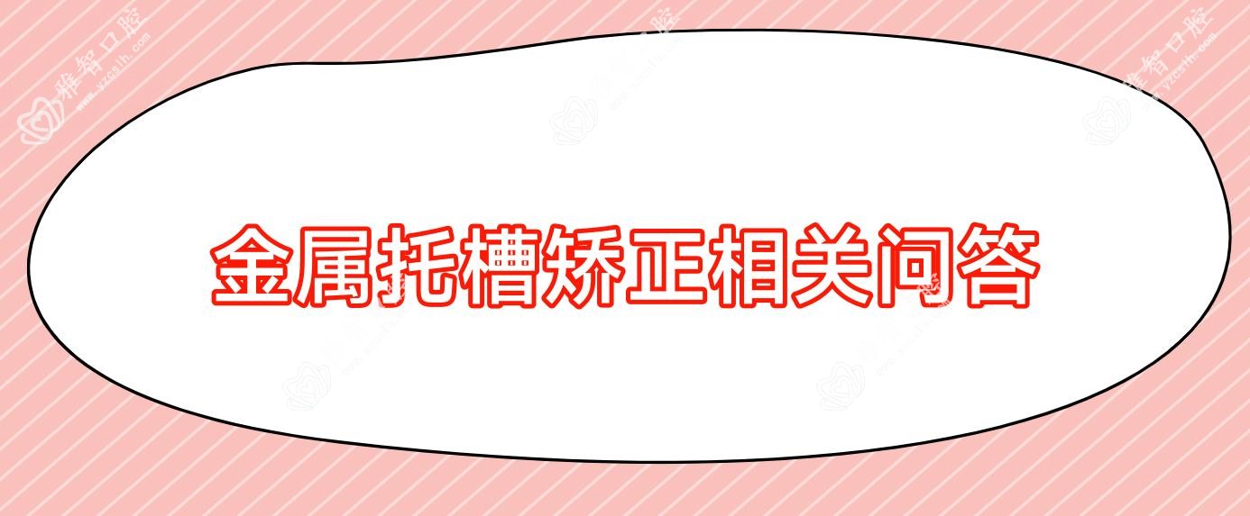 金属托槽矫正相关问答