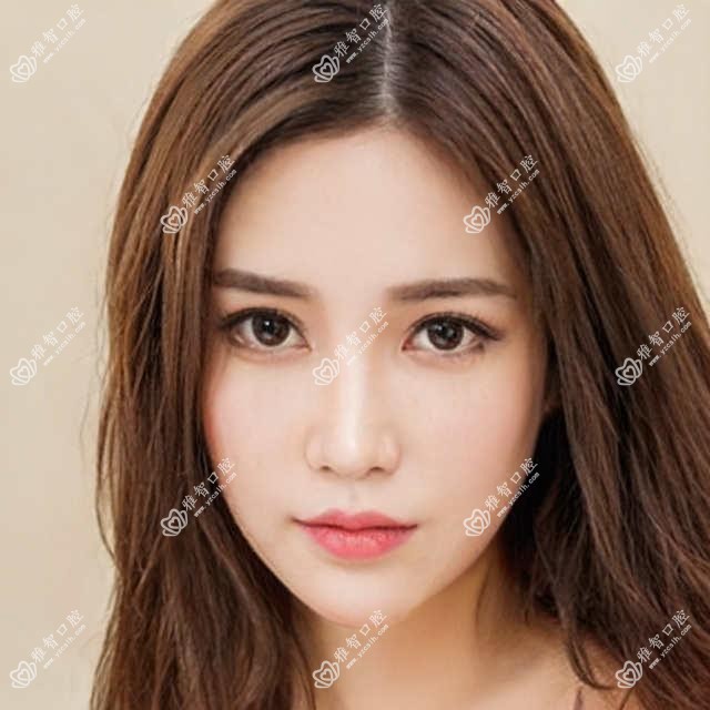 东莞百齿泰种植牙价目单总览,想变好看的小伙伴能参照