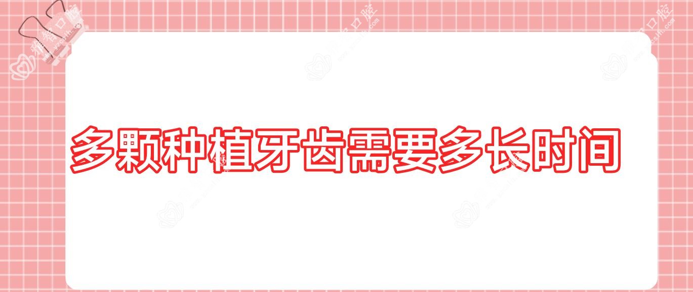 多颗种植牙齿需要多长时间
