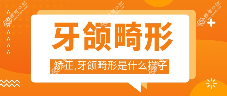 牙颌畸形矫正,牙颌畸形是什么样子