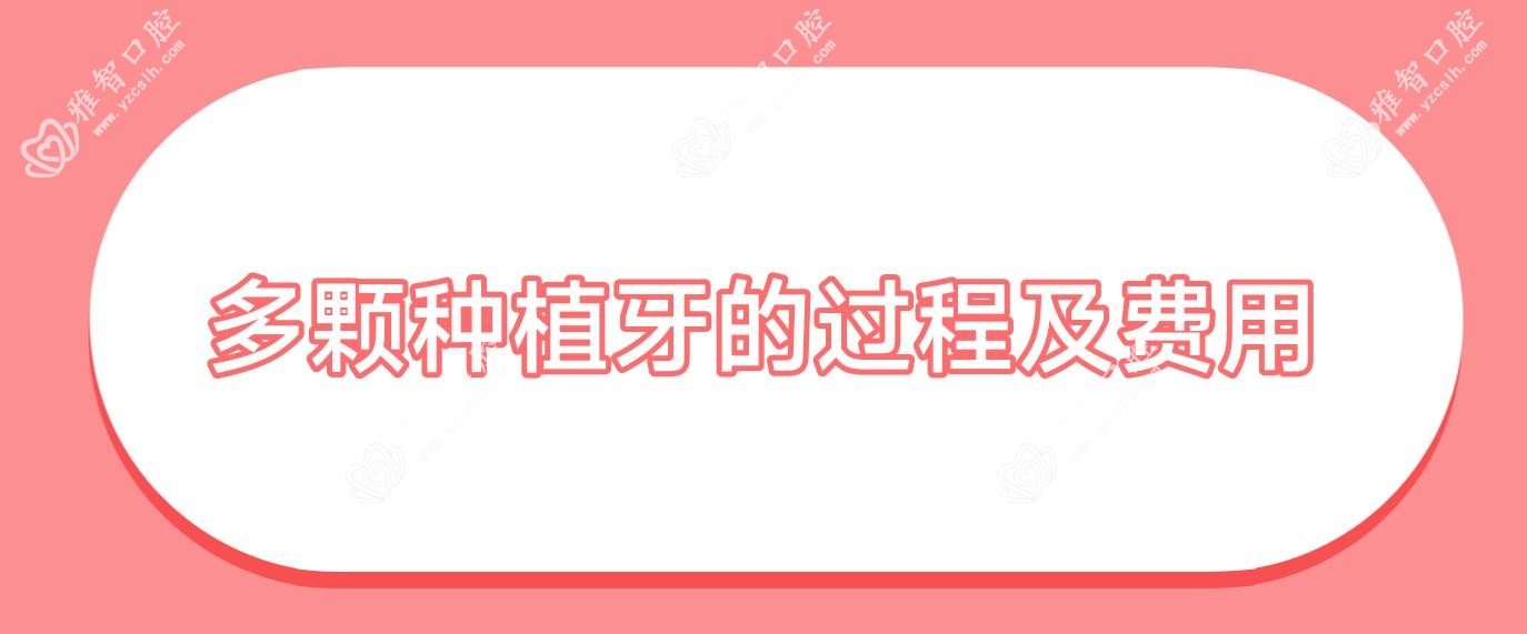 多颗种植牙的过程及费用