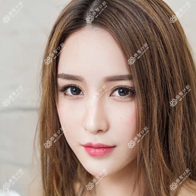 珠海牙齿脱落一般多少钱?牙齿脱落2.7千元左右