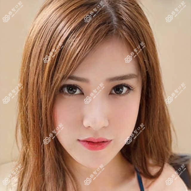郑州氟斑牙美白多少钱?2025年详细氟斑牙美白价目单