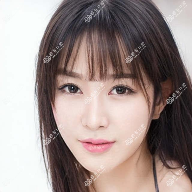 青岛CDIC种植牙价格收费收费表2025（青岛CDIC种植牙价格价格概览表）