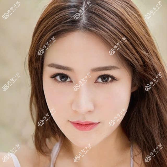 牙龈炎的项目百科 牙龈炎手术注意事项
