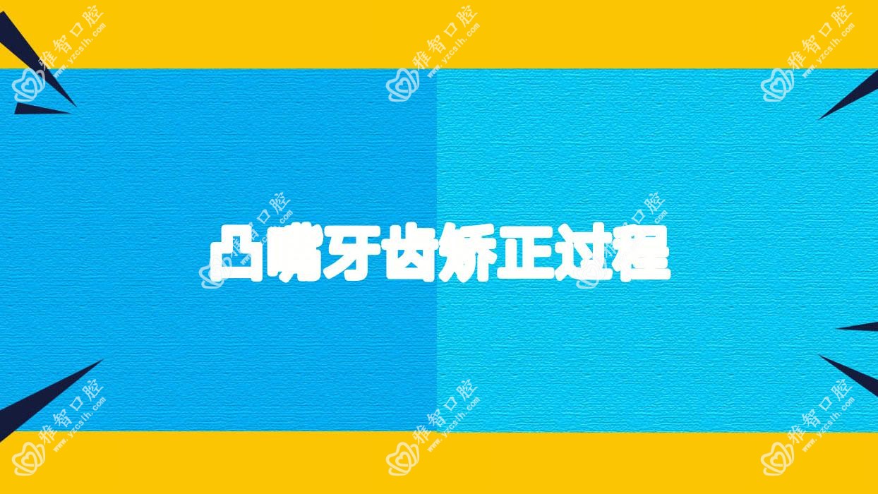 凸嘴牙齿矫正过程