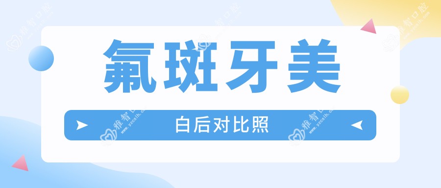 氟斑牙美白后对比照