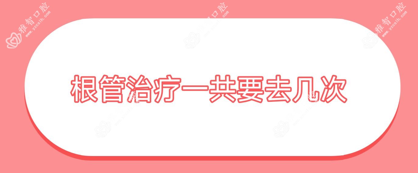 根管治疗一共要去几次